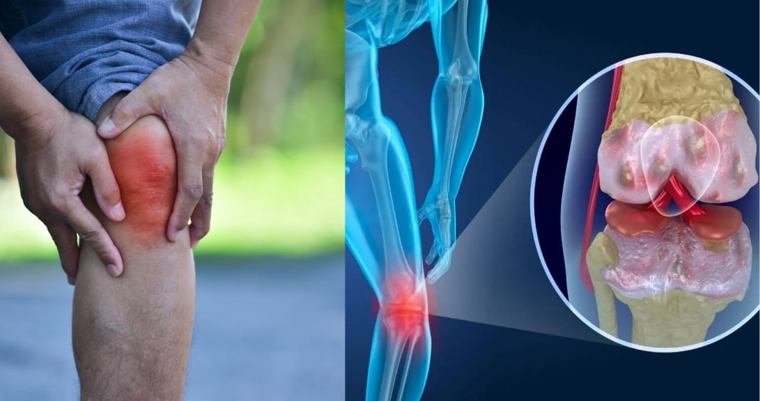 Wellnee Knee Brace 8